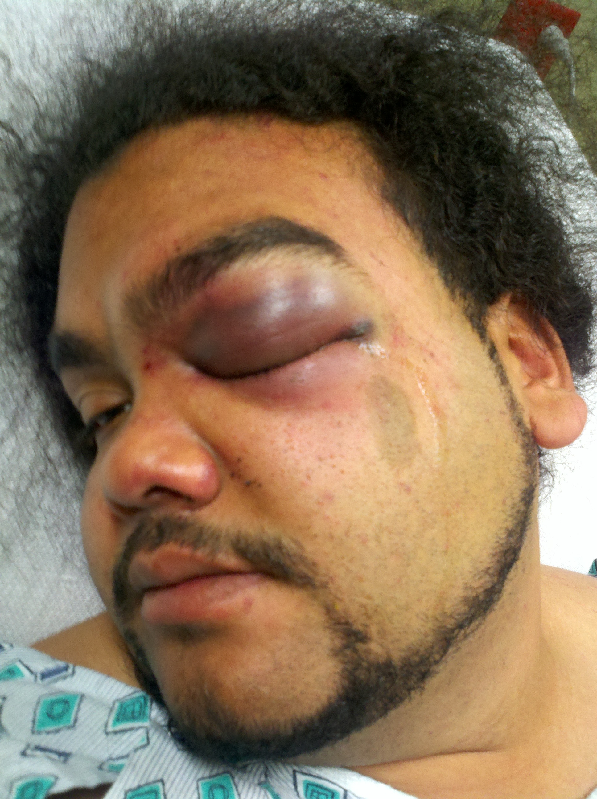 <b>Jose Lugo</b> Not Guilty of Assaulting Rochester, NY Police Officer. Juror: - Lugo-71